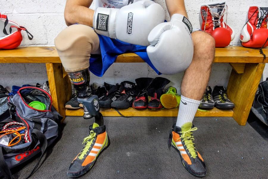 Andres Felipe Diaz Mateus’ prosthetic leg is made with carbon fiber from ashes of volcanoes, and has a sticker representing his native country of Colombia. Mohammed F. Emran | Staff Photographer