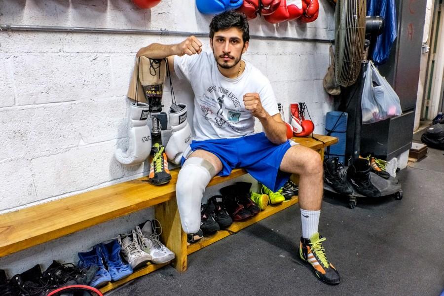 Diaz Mateus poses with his prosthetic leg off. Mohammed F. Emran | Staff Photographer